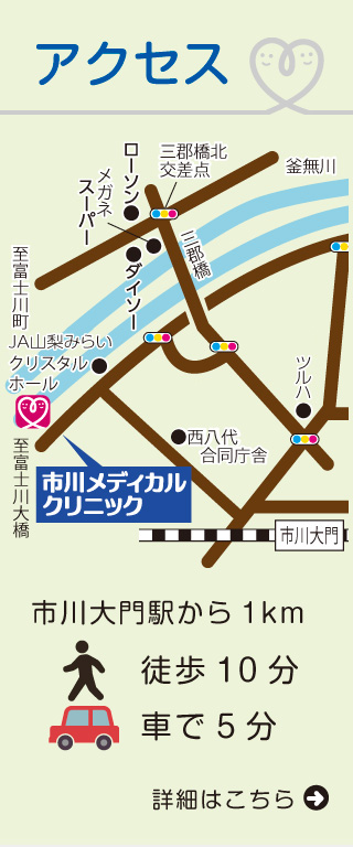 アクセス